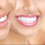 Facts About Peptide Supplements