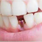 Top benefits of sending your kids to the preschool childcare centres