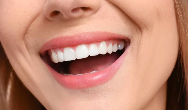 Dental Crowns Newcastle