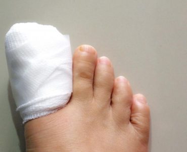 Infected Toenail Removal